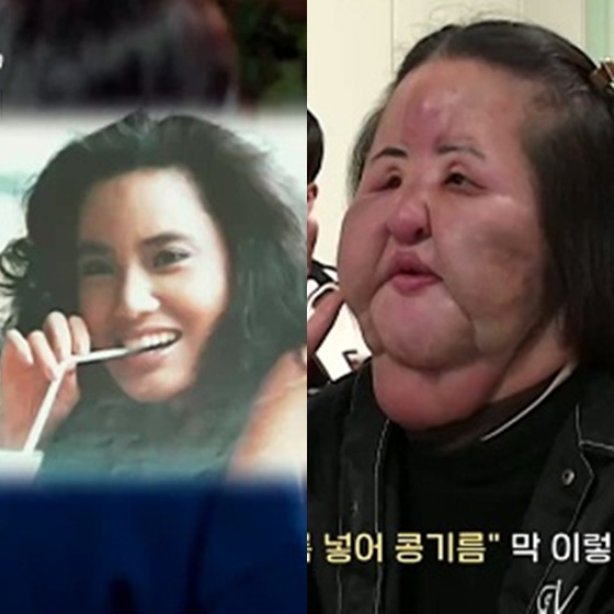 /Photo = SBS "The Story of the Day You Bite Your Tail"