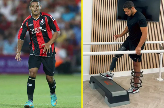 Jordan Chiedoji (left) and his leg amputation during the AFC Bournemouth period. /Photo = British talk sports finish