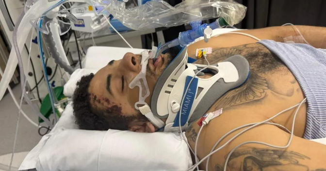 After Jordan Chiedoji surgery./Photo = BBC adaptation