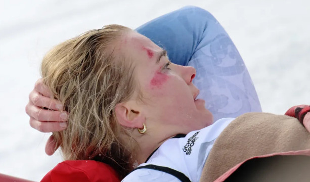 图为在比赛中发生事故出血的马特·蒙森。 =照片=《太阳报》结束。