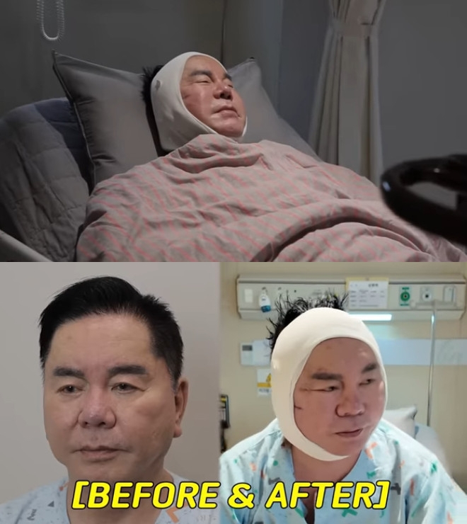 Shim Hyung-rae / Photo = YouTube channel Young-won TV