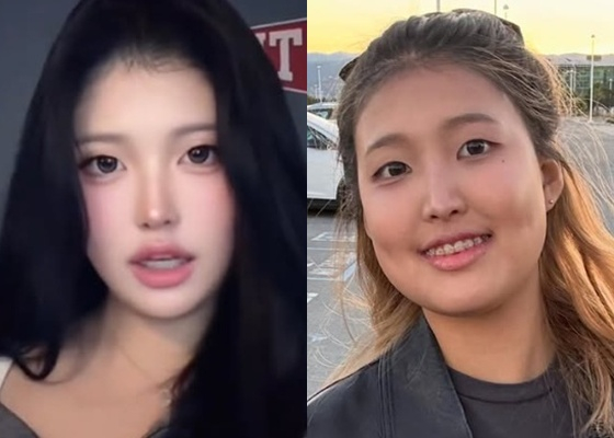 /Photo = Hong Jin-kyung SNS