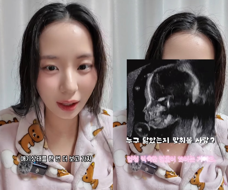 /写真=チェ·ヨンスのインスタグラム