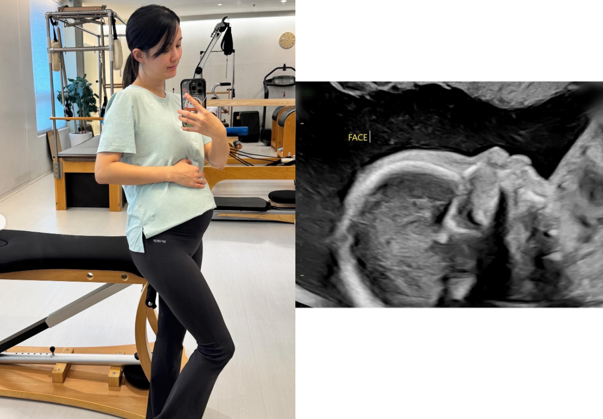 Photo = Nam purple Instagram