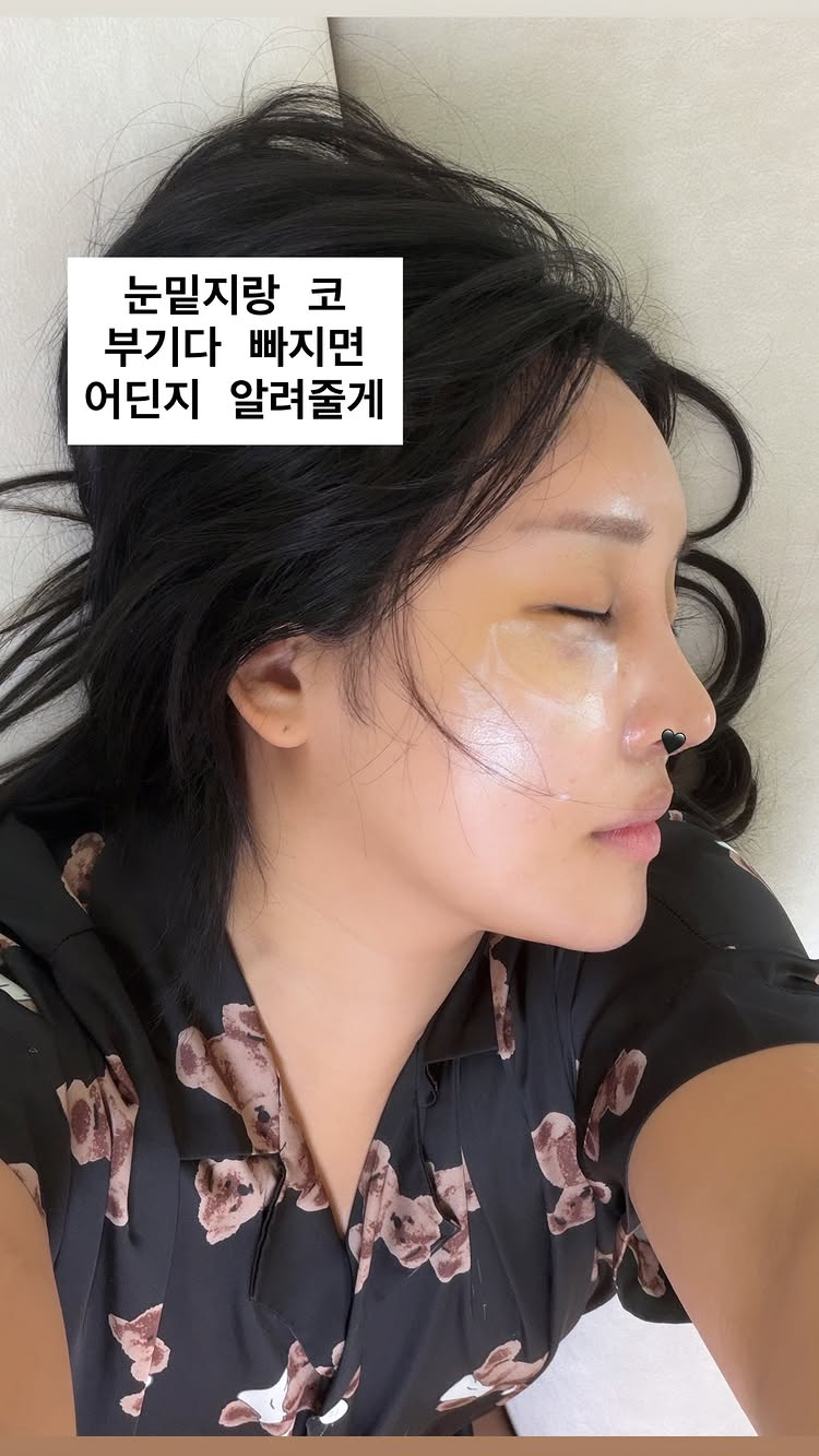 /Photo = Lalalal SNS