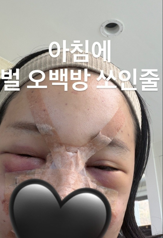 /Photo = Lalalal SNS