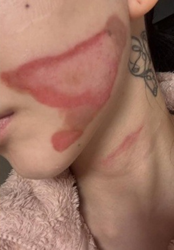 /写真=クォン·ミナSNS