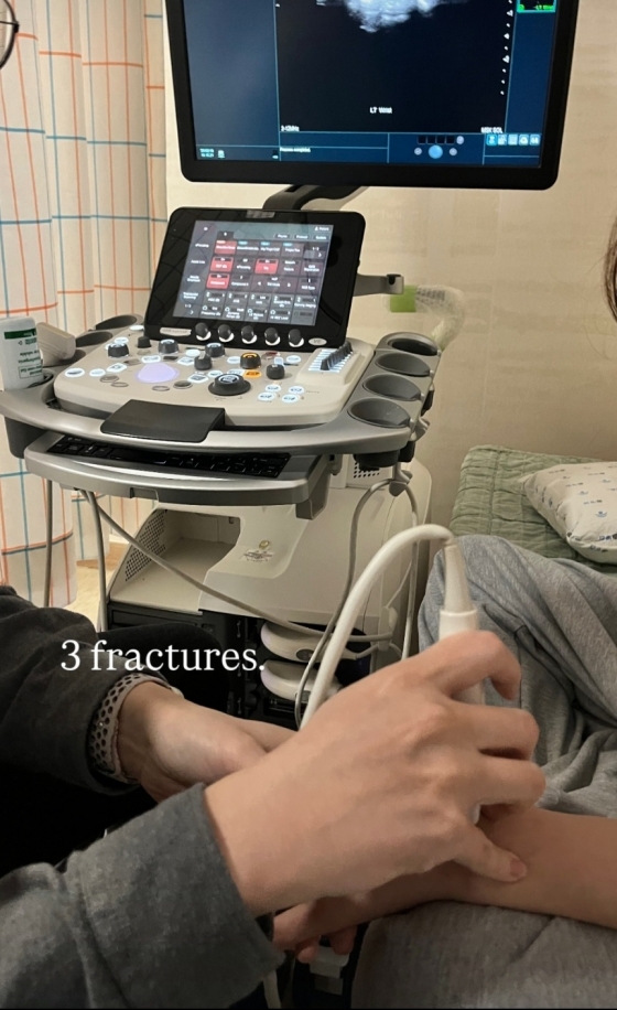 崔佳温上传了"3 fractures（三处骨折）"的字样和在医院接受检查的照片。 =照片:崔佳温的个人社交网络服务（SNS）