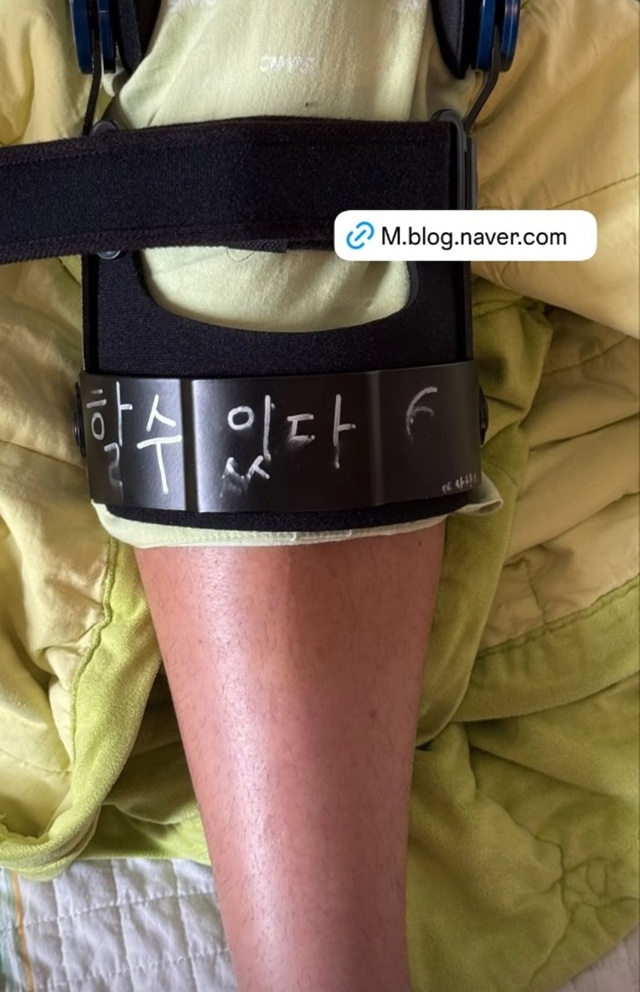 在手术后佩戴的石膏上写下"可以做到"的信息后公开的仁川联合队的文志焕（音）。 =照片=文志焕SNS。 