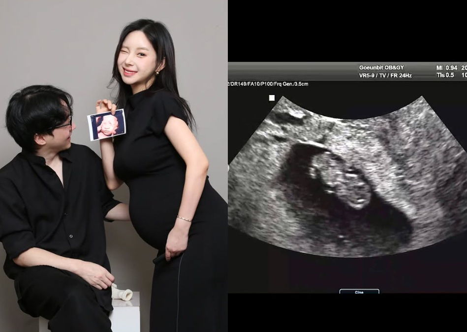 =照片:全善旭的SNS。