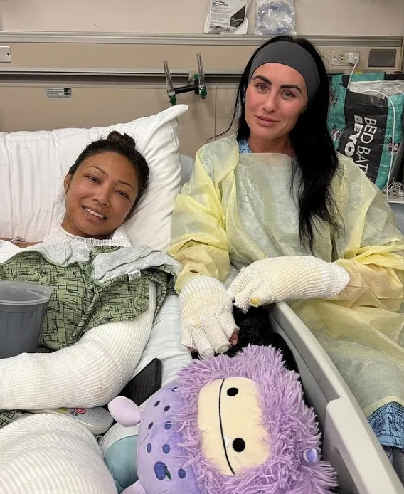 因烧伤事故接受治疗的珍妮·李（左）和凯莉·玛丽·沃尔顿。 =照片=《太阳报》结束。