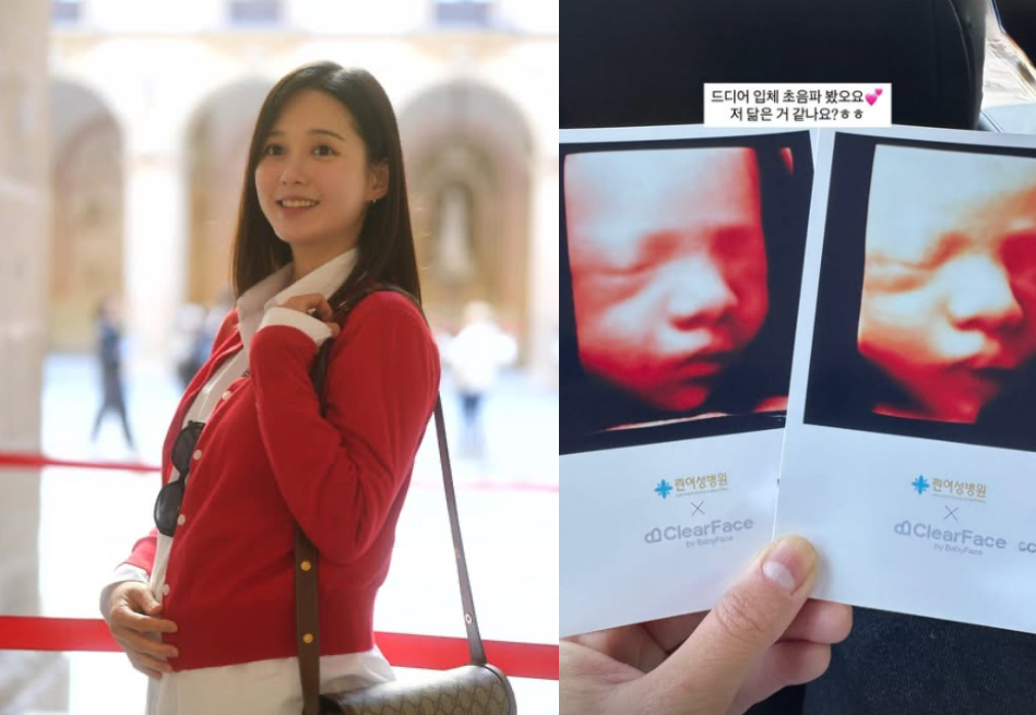 '6월 출산' 남보라, 子 입체초음파 공개..벌써부터 완성형 이목구비
