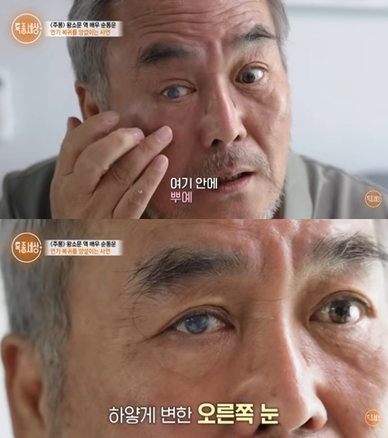 '주몽' 순동운, 실명된 눈 공개 "백태 심해져"→낙상사고로 마비까지 [스타이슈]