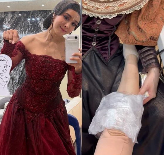 핑클 이효리 '부친상' 속..옥주현 "크게 넘어져, 일어날 수 없었다" 부상 투혼 근황 [스타이슈]