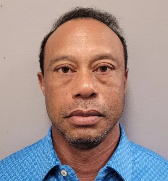 동공 풀려 길바닥에 꿇은 '골프 황제'... 우즈, 마약성 진통제 처방 기록도 은폐 시도 "사생활이다"