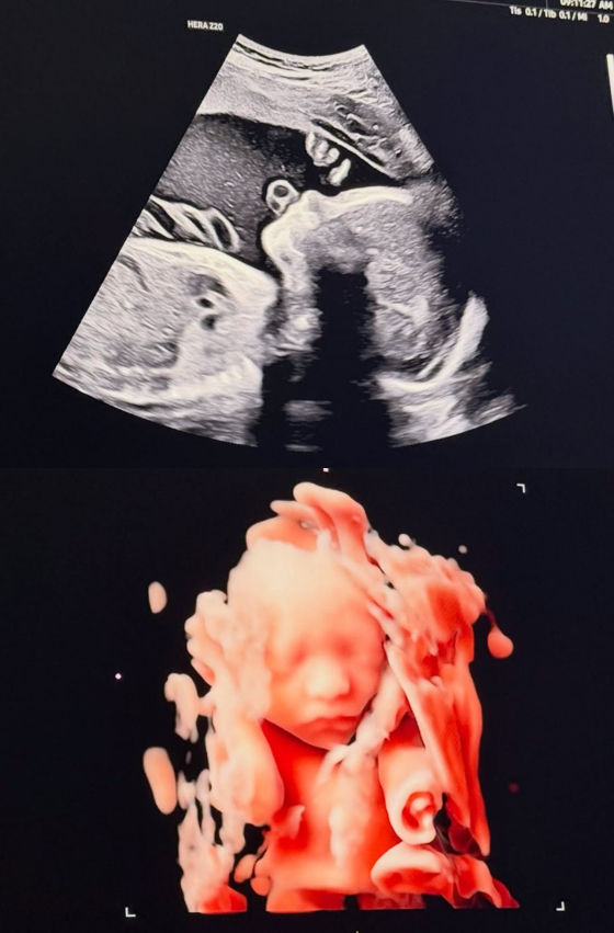 /Ảnh = Instagram của Song Seung Hyun