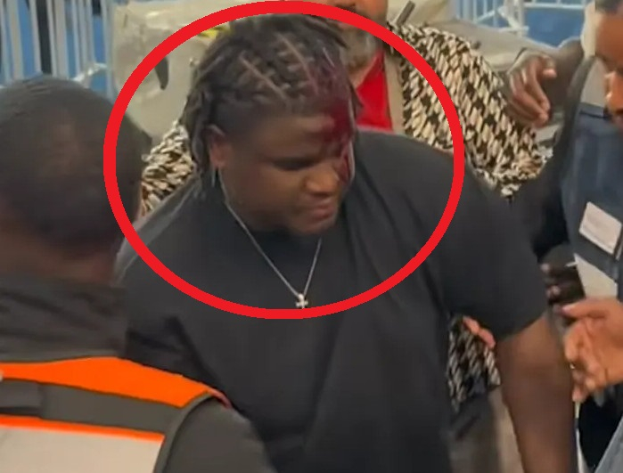 图为达约·乌帕梅卡诺的友人在观看比赛时被投掷物击中受伤。 =图片=图片结束。