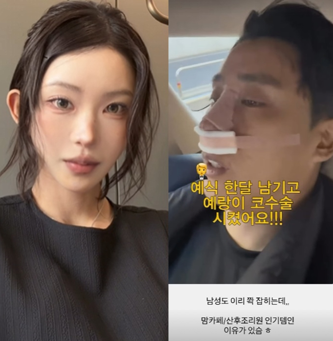 '성형 전문러' 최준희, 남친도 코 수술했다 "사랑하면 닮아" 경악[스타이슈]