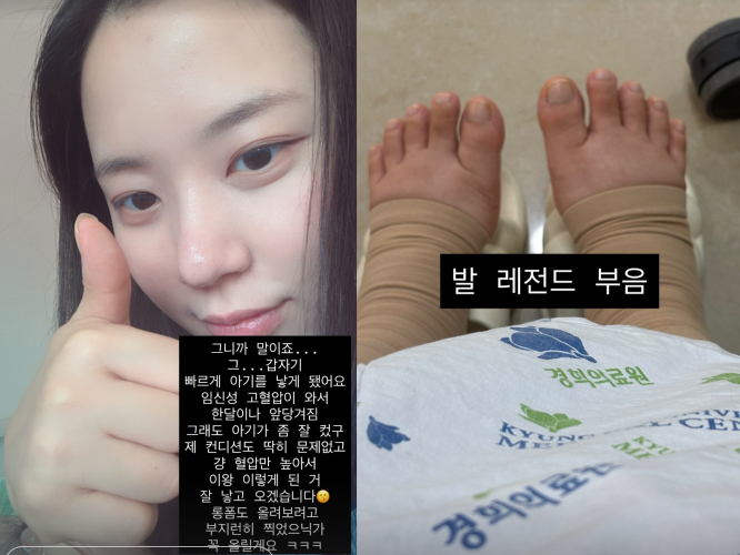 /Ảnh = SNS của Choi Yeon Soo