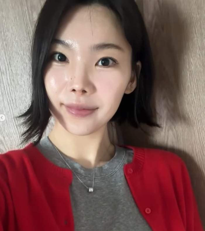 '턱 보톡스 부작용' 호소한 '돌싱글즈2' 이다은.."♥윤남기 예쁘다 해줘" 속상한 건지? 자랑인지?