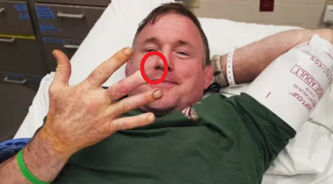 Matt Hughes muestra el dedo que le fue amputado. /foto=The Sun (recorte)