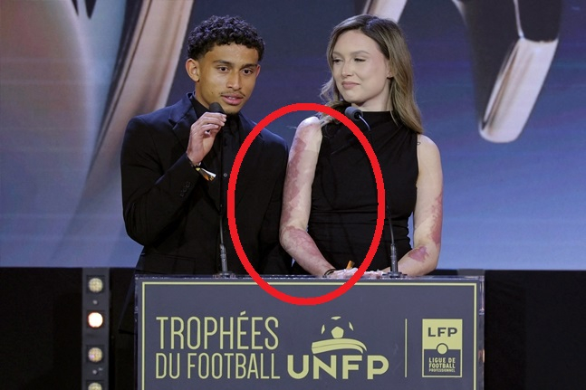 Tahiris Dos Santos Toss (izquierda) y Colin. /foto=NEWS1