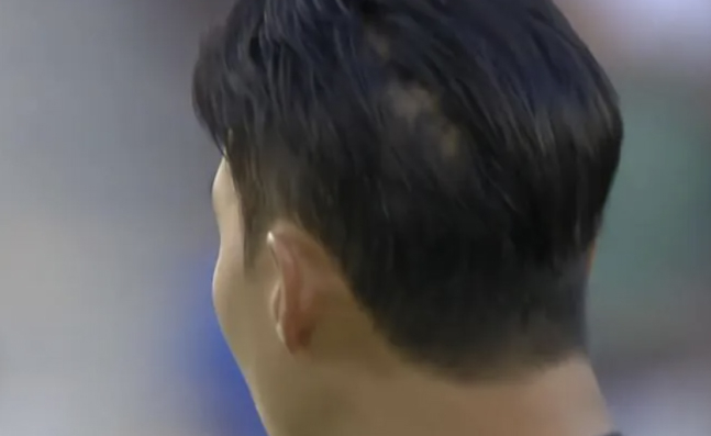 The back of Son Heung-min's head, who started in the 2026 Major League Soccer (MLS) Round 15 match against Seattle Sounders held at BMO Stadium in Los Angeles, USA, on the 25th. /Photo=Broadcast screen capture