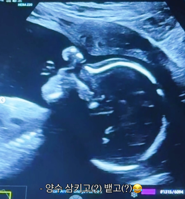 /Photo=Kim Min-kyung SNS