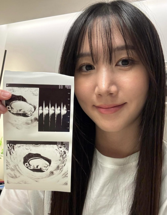Hong Yoo-kyung / Photo=Hong Yoo-kyung Instagram