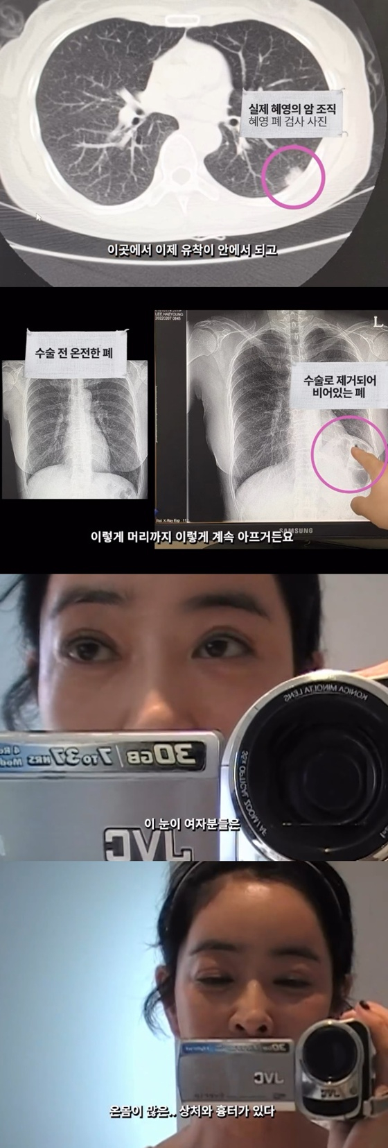 /Ảnh = SNS của Lee Hye Young