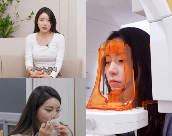 31st Season Jeong Hee / Photo=Thank You Plastic Surgery Clinic SNS