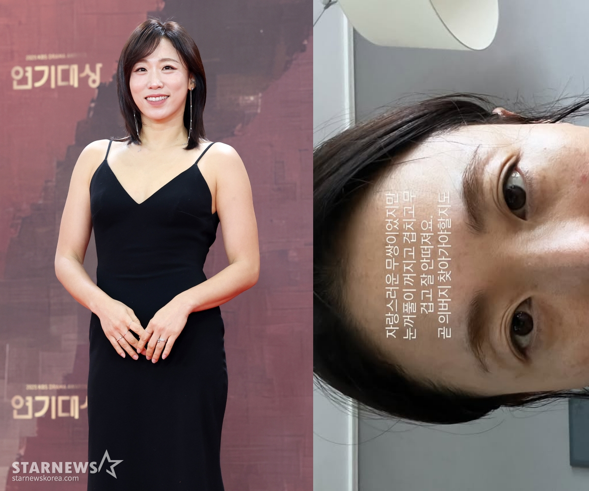 이미도, 솔직 외모 고민 "눈꺼풀 꺼져..의사 찾아가야 할지도"