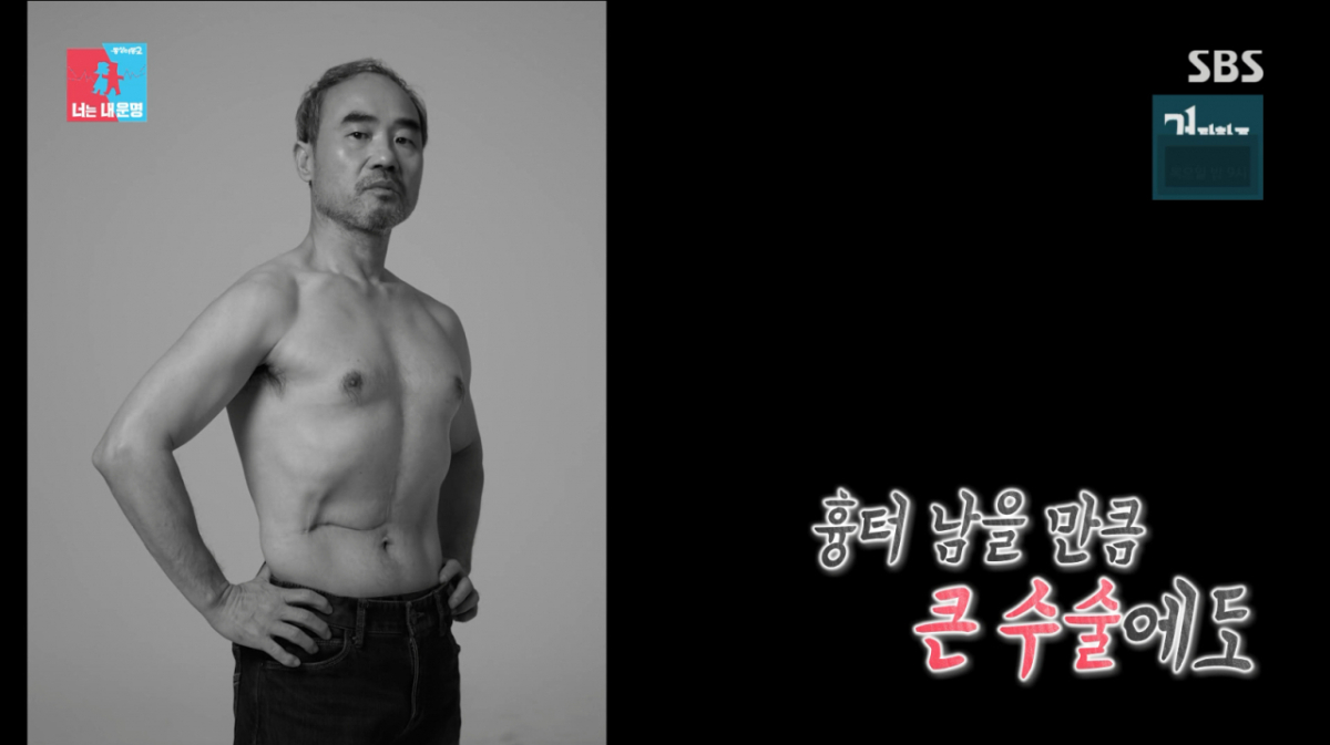 강신일, 간암 수술 2주 만에 복귀한 사연.."가장 큰 이유? 책임감"[동상이몽]