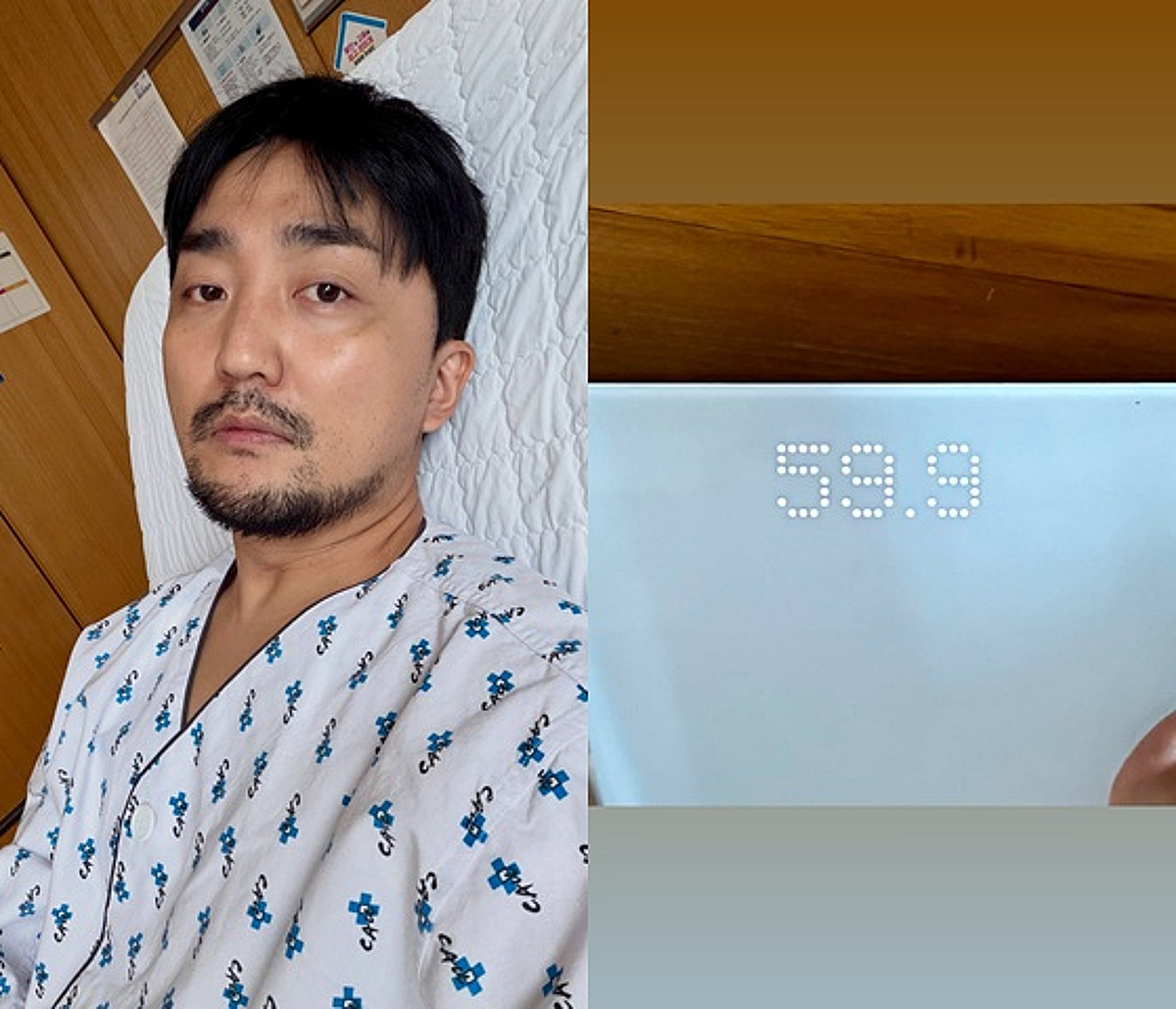 유병재, '담낭절제술' 후 50kg대 몸무게..핼쑥한 얼굴까지 '걱정'