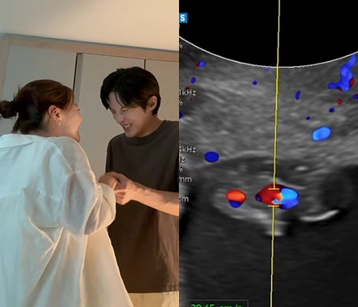 김가은♥윤선우 "아기천사가 찾아왔어요..6식구" 결혼 1주년에 겹경사 [스타이슈]