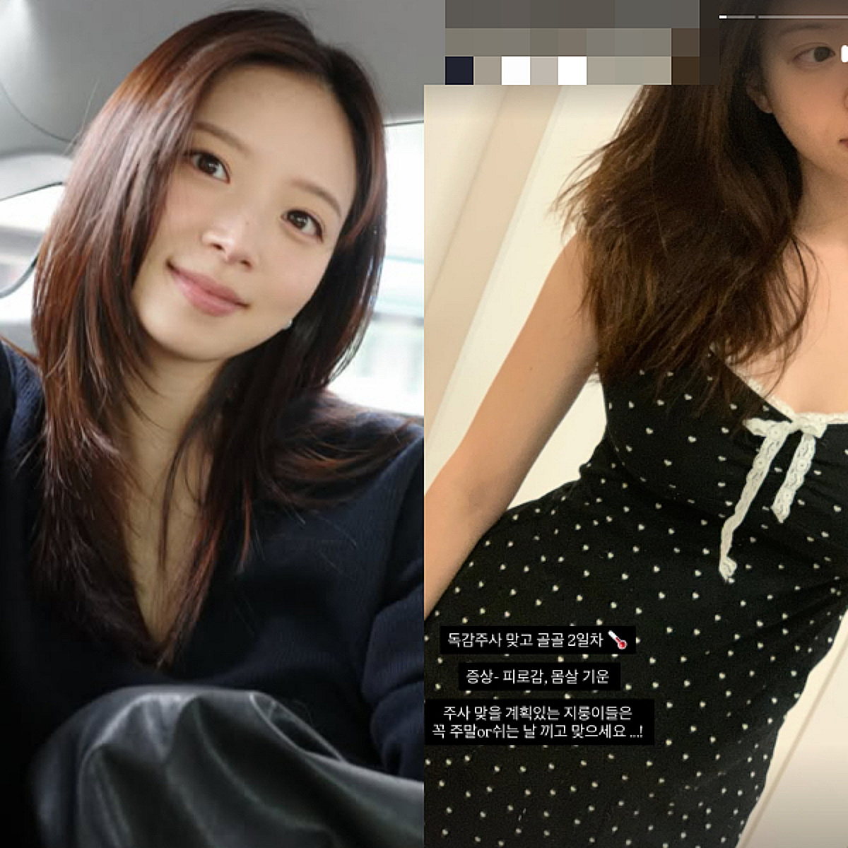 녹내장 이어 몸살까지..김지영 "독감주사 맞고 골골" 걱정 가득[스타이슈]