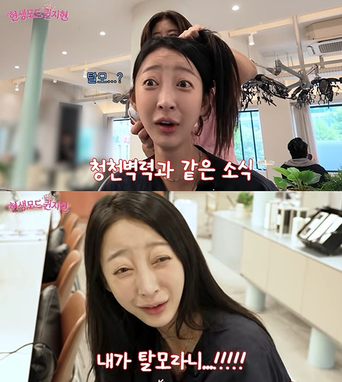 EXID 혜린, 탈모 진단에 충격 "모공 사이 간격 넓어..두피 관리 시급"