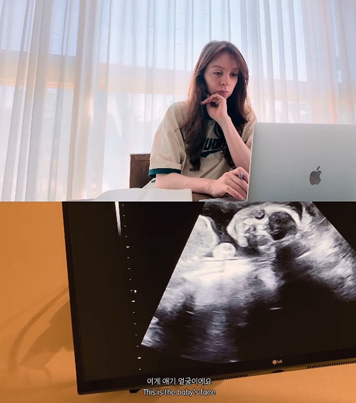 '박주호♥' 안나, 암 투병 딛고 넷째 임신 "힘든 시간 버티고 찾아온 희망" [스타이슈]