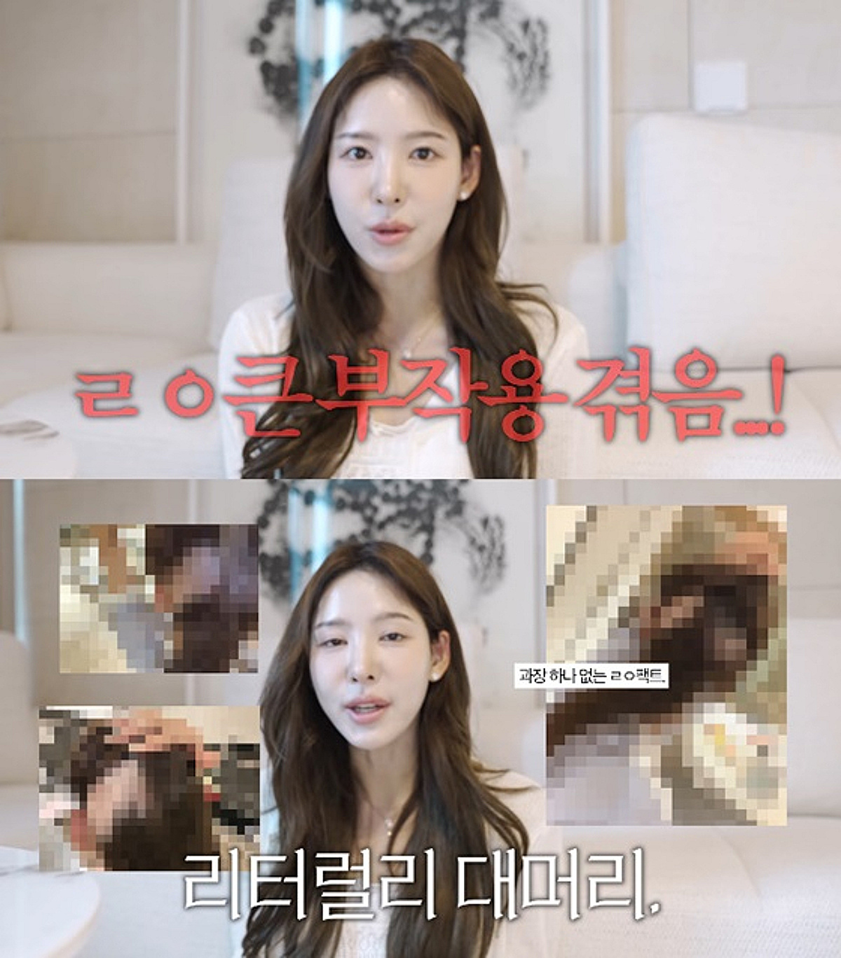 "JTBC 에어컨 안 나와" 발언한 이나연, 대머리 고백 "모발 이식 부작용"