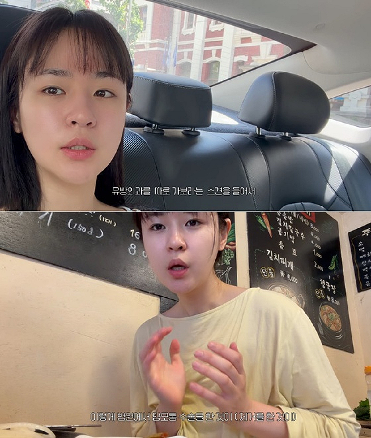 심은우, 과증식 섬유선종으로 수술 "다행히 악성은 아냐"