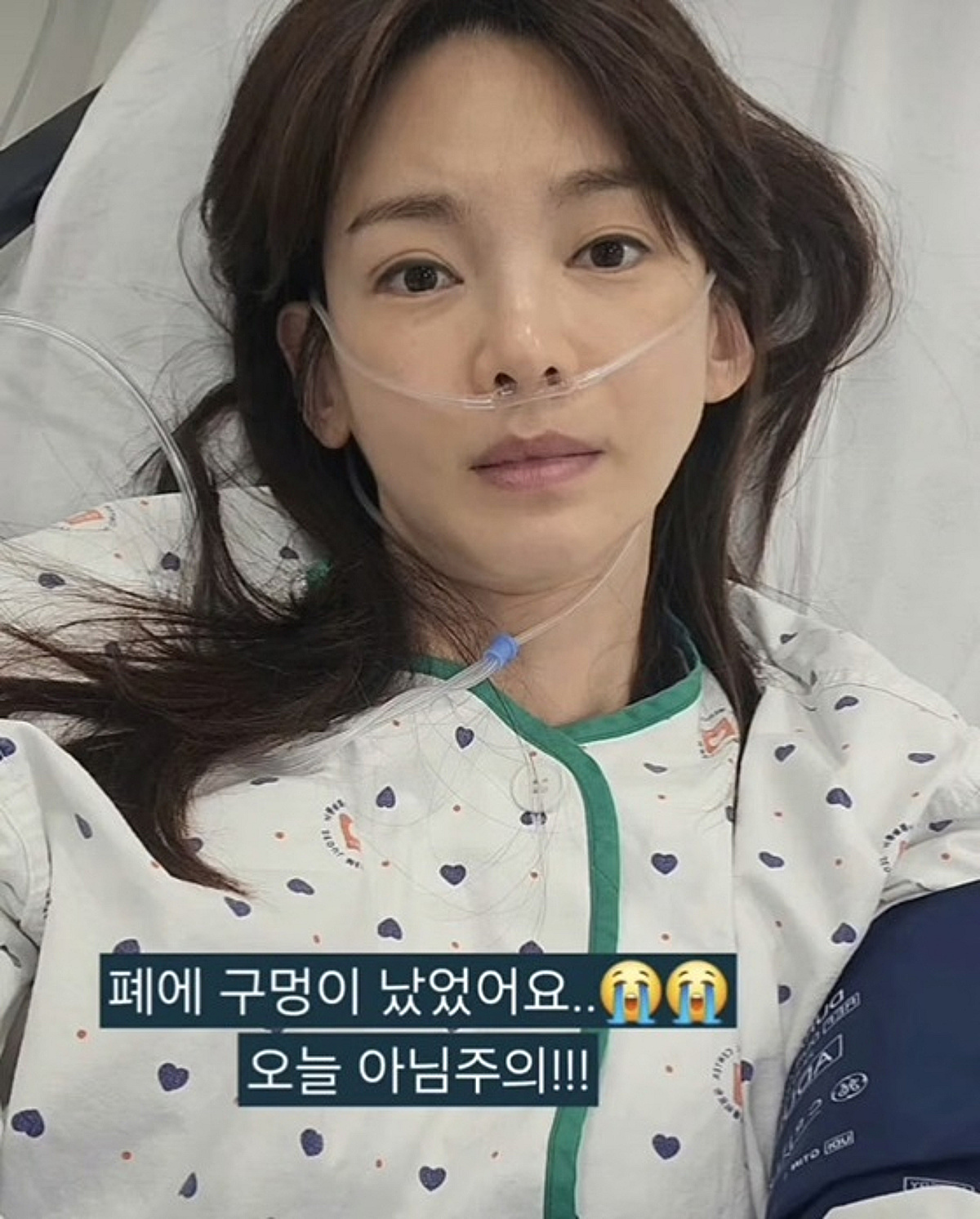 정가은, 근황 뜸했던 이유..코에 호스 꽂고 치료 "폐에 구멍"
