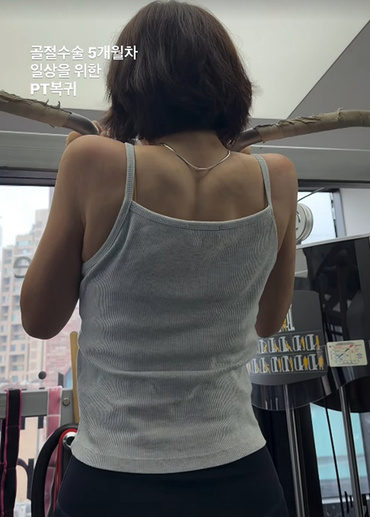 '여행 중 발목 골절' 엄지원, 수술 5개월 차 근황.."일상 위한 PT 복귀"