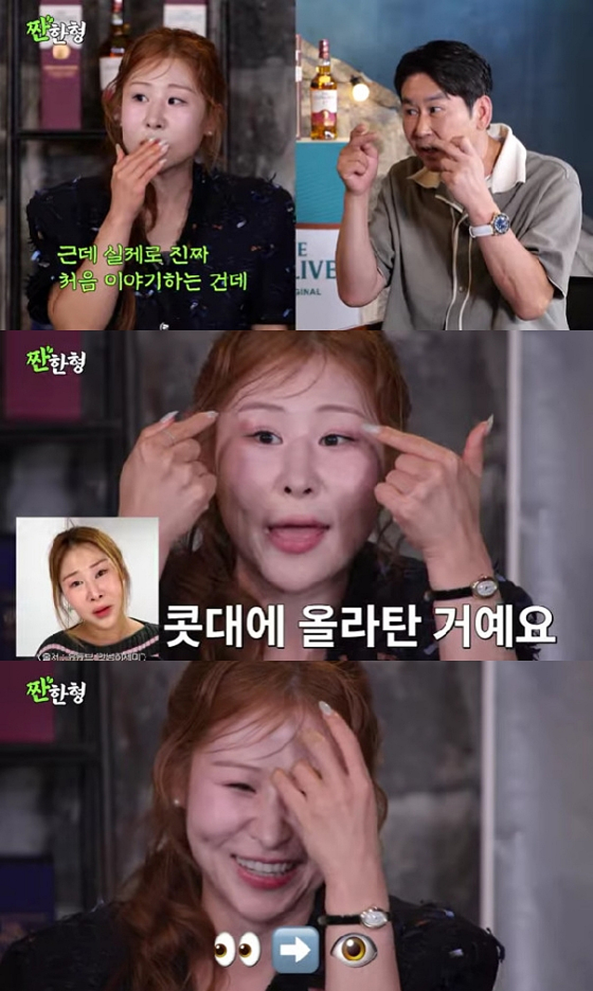 박세미, 성형 부작용 고백 "코 구축 와 재수술..앞꼬리 올라타"[짠한형]