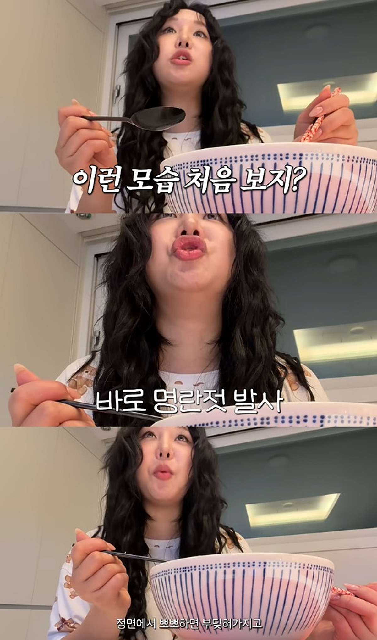 랄랄, 코 성형 후 불편해진 ♥남편과 스킨십.."정면에서 뽀뽀하면 부딪혀"