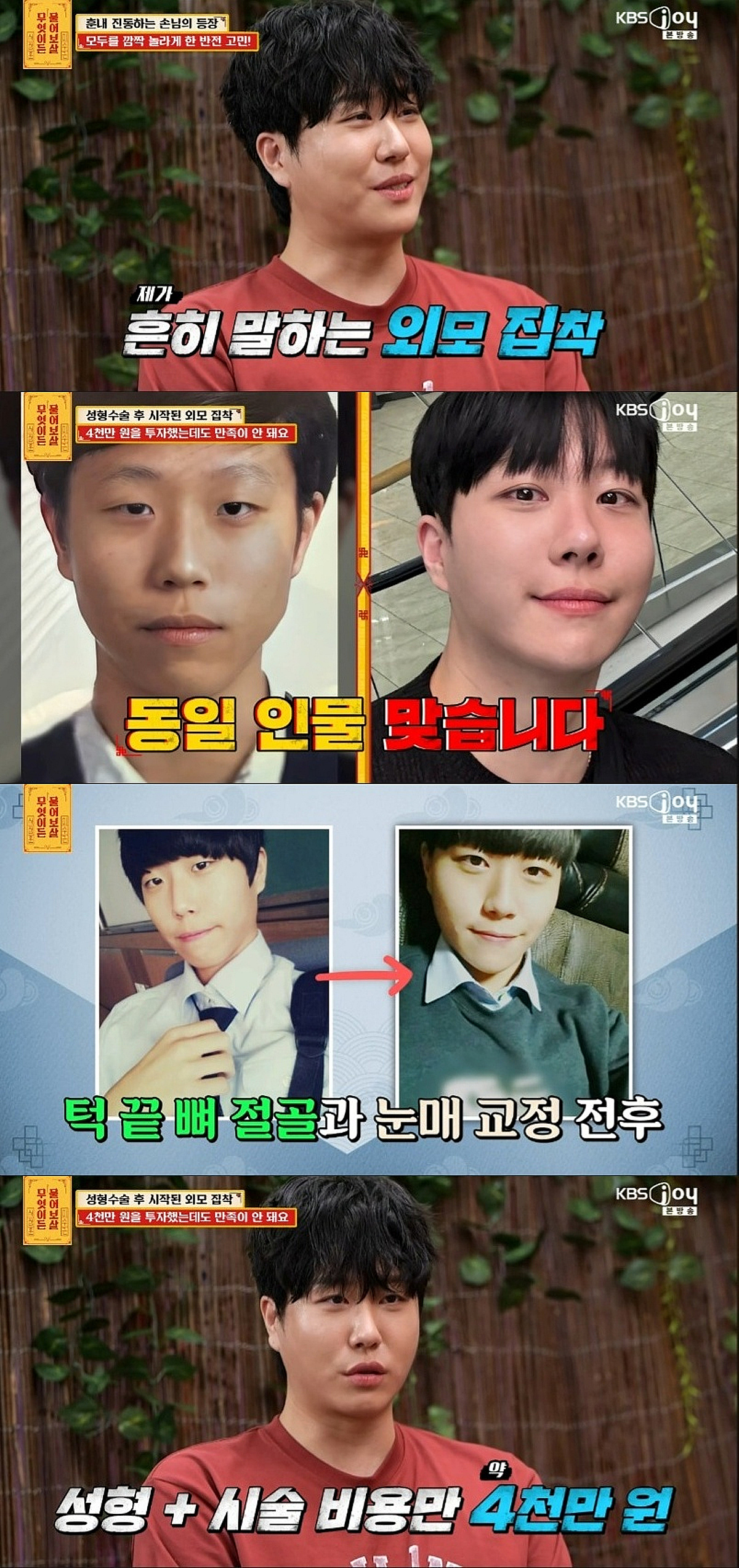 성형에 4000만원 쓴 중독男, 비포애프터 보니..서장훈 쓴소리 왜?[물어보살][★밤TV]