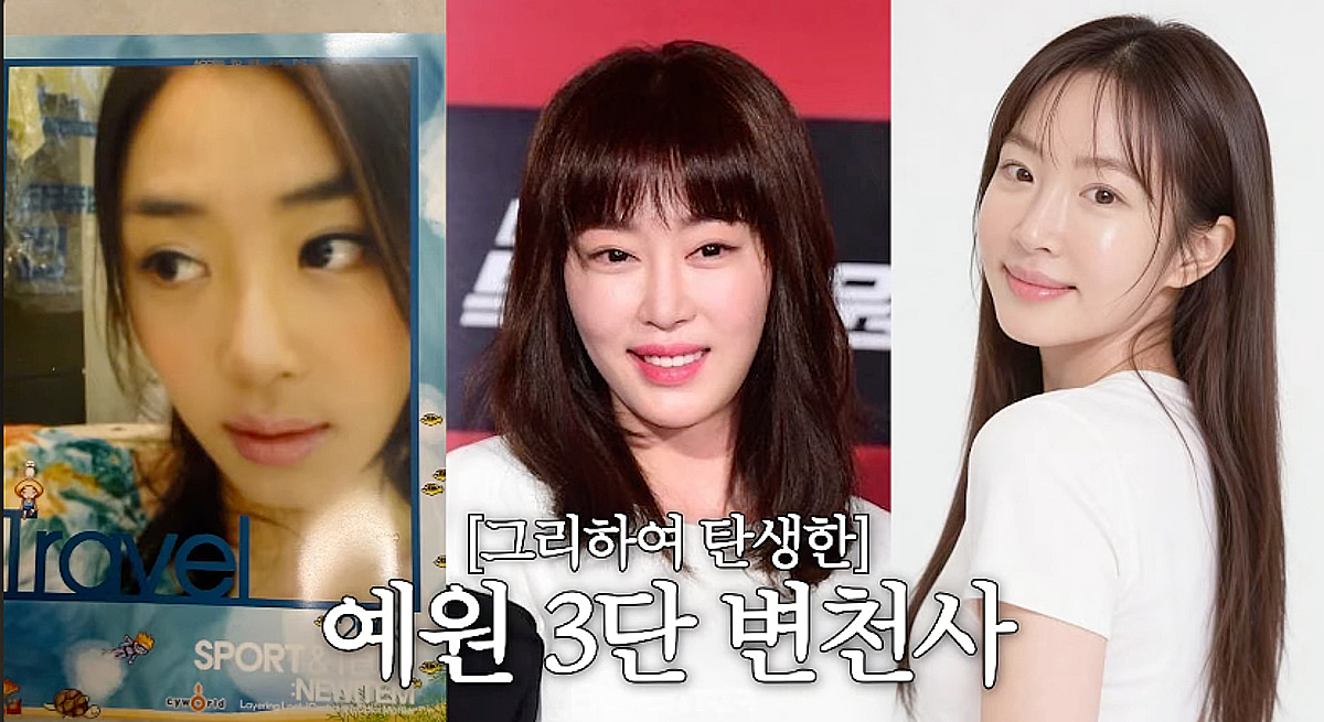 '앞트임 복원' 강예원, 코성형 고백 "코 살짝..눈 7번" [광예원]