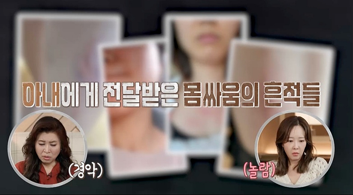 남편, 술만 마시면 '소변 실수+폭력 행동' 경악.."입원 치료해야" [결혼지옥]