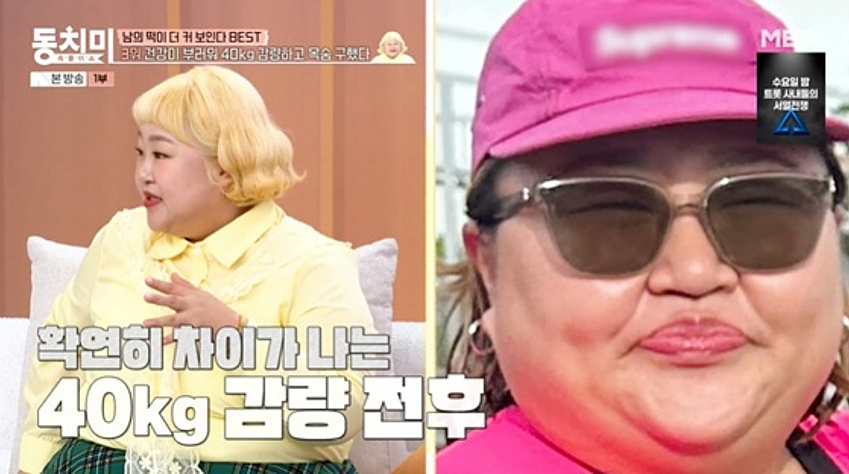 홍윤화, 40kg 감량 전후 사진 공개 "십자인대 수술 후 최대 몸무게"[동치미]