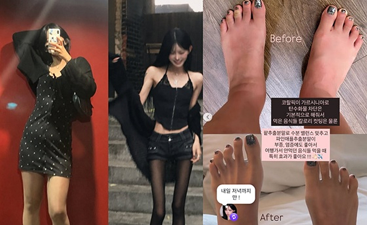 '55kg 감량' 최준희, 발가락 살마저 빠졌다.."다이어트 실패 이유? 먹은 뒤 관리 안 해서"