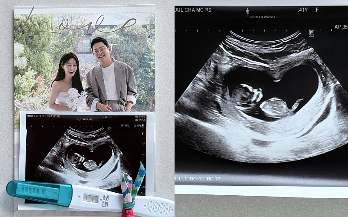 [속보]김지민♥김준호 부모 된다..임신 깜짝 발표 "태명은 두룹이"